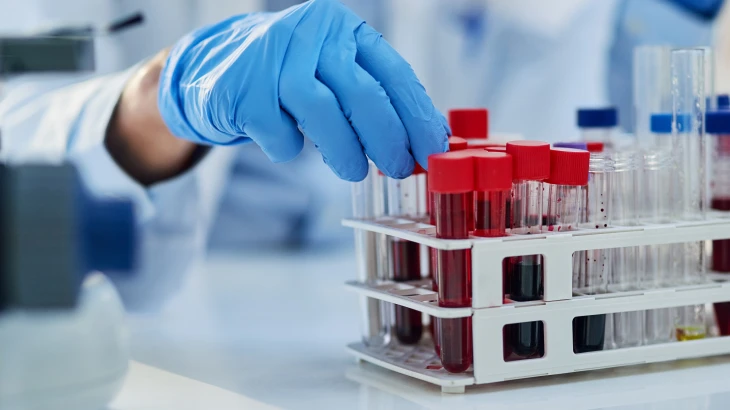 Médica organizando os tubos de sangue